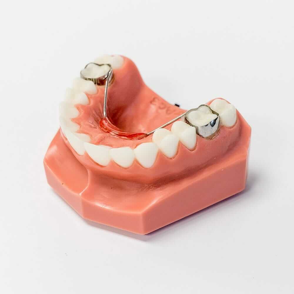 Orthodontic Appliances