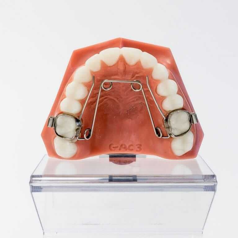 Quad Helix Appliance