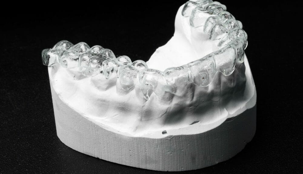 weigh the pros and cons of a local orthodontist versus at home braces companies like smile direct club and candid clear aligners and byte