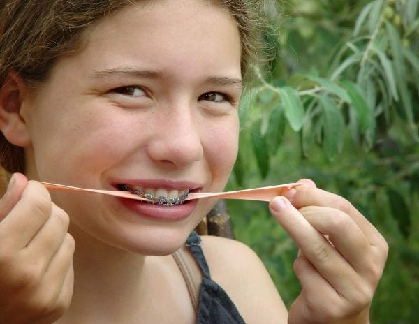 Avoid hard, crunchy, chewy, and sticky food while wearing braces and appliances.