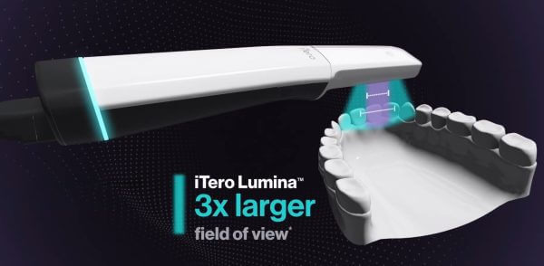 Burke & Redford Orthodontists Uses the Latest Digital Scanning Technology for Children and Teens in our Office, which is the iTero Lumina Intraoral Scanner.