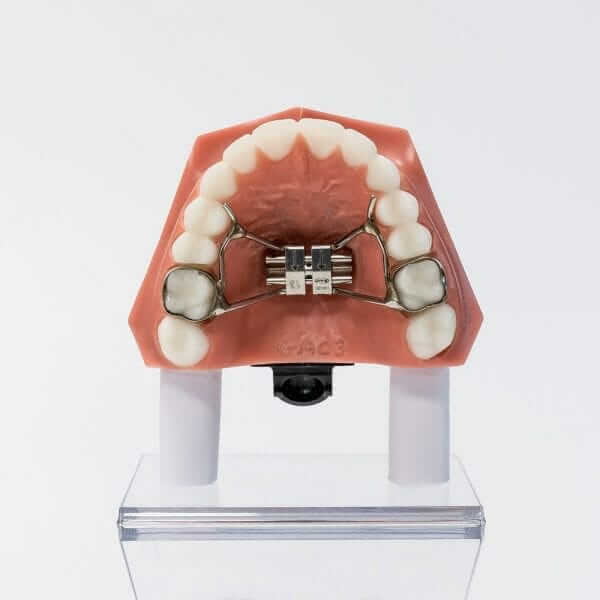 banded expander banded expander