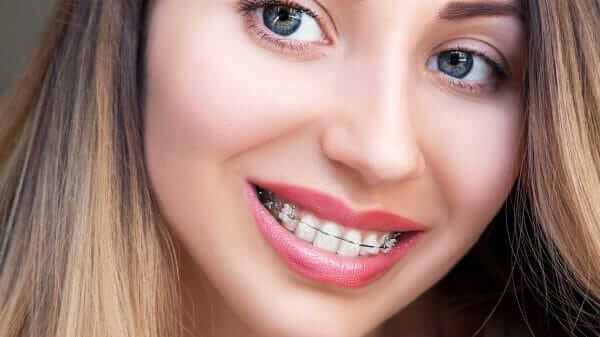 damon system bracelift and damon clear braces damon braces and the damon system bracelift orthodontist temecula