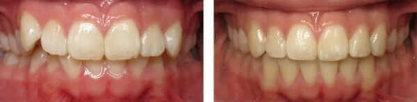 top damon braces orthodontist