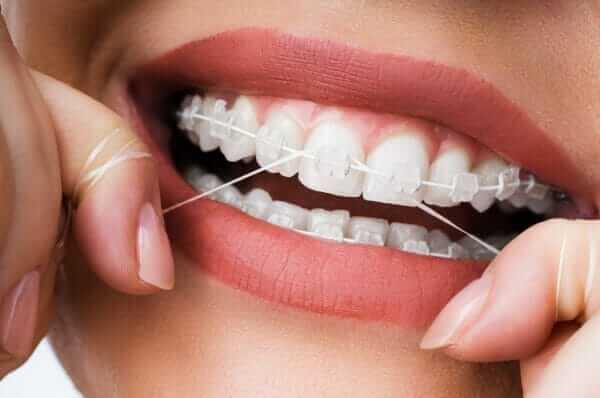 flossing with braces