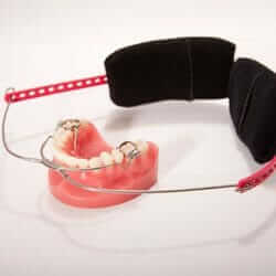 Orthodontic Head Gear Orthodontic Head Gear