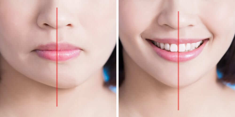 jaw misalignment treatment orthodontist jaw misalignment treatment orthodontist