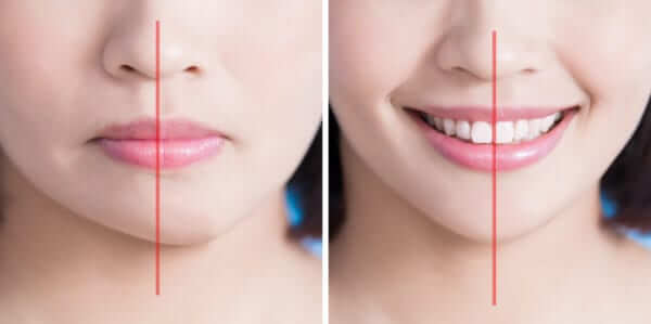 jaw misalignment treatment orthodontist