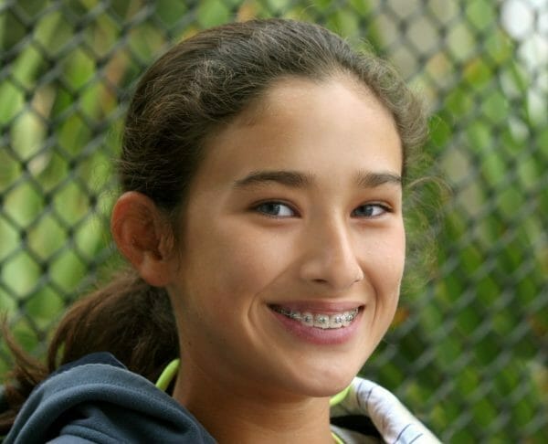teen braces teen braces