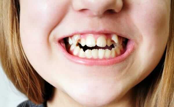 Pediatric Orthodontists Temecula Pediatric Orthodontists Temecula
